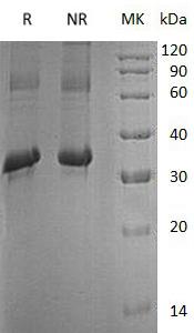 Human ITLN1/INTL/ITLN/LFR/UNQ640/PRO1270 (His tag) recombinant protein