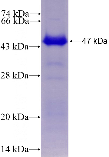 Recombinant Human SMYD4 SDS-PAGE