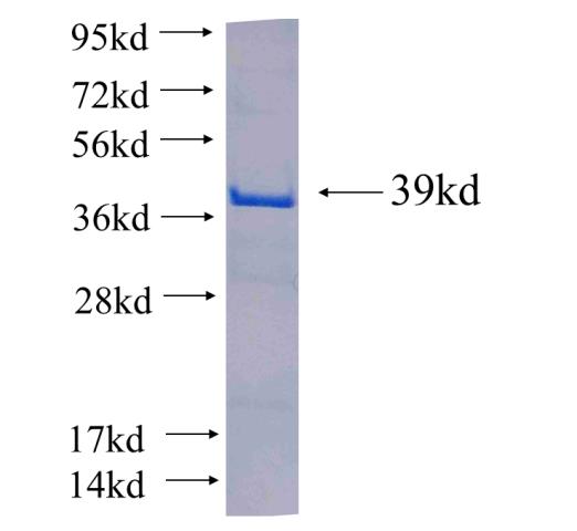 Recombinant human STARD10(Full length) SDS-PAGE