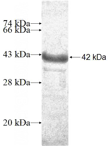 Recombinant Human BRMS1 SDS-PAGE