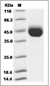 Influenza A H7N9 (A/Hangzhou/1/2013) Hemagglutinin Protein (HA1 Subunit) (His Tag) SDS-PAGE