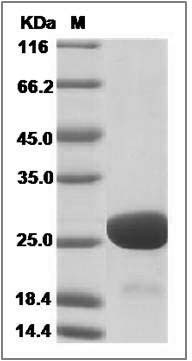 Human Immunodeficiency Virus type 1 (HIV-1) Gag-p24 Protein (subtype B, His Tag) SDS-PAGE