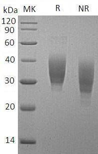 Mouse Slamf7 (His tag) recombinant protein