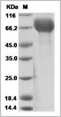 Influenza A H7N7 (A/Netherlands/219/2003) Neuraminidase / NA Protein (His Tag)