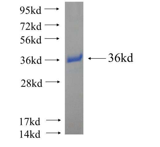 Recombinant human SRP9 SDS-PAGE