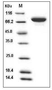 Human XPNPEP2 / X-Pro aminopeptidase 2 Protein (His Tag) SDS-PAGE
