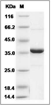 Human PTPN2 / PTPT Protein SDS-PAGE