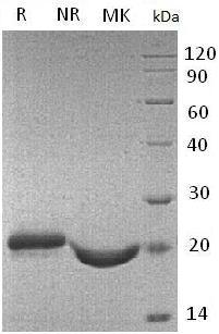 Mouse Timp2/Timp-2 (His tag) recombinant protein