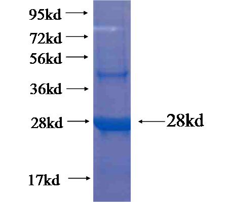 Recombinant human FAM155B SDS-PAGE
