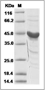 Mouse EphA3 Protein (aa 569-984) SDS-PAGE