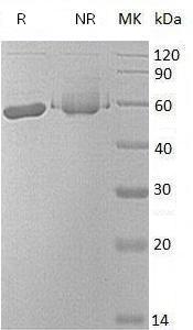 Human ALDH3A1/ALDH3 (His tag) recombinant protein