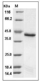 Mouse PTPN2 / TC-PTP Protein (aa 2-314, His Tag) SDS-PAGE
