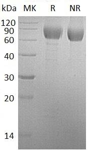 Human PLXDC1/TEM3/TEM7 (His tag) recombinant protein