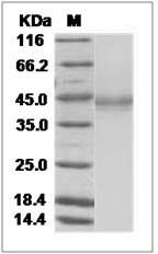 Bovine Enterokinase / PRSS7 Protein (His Tag) SDS-PAGE