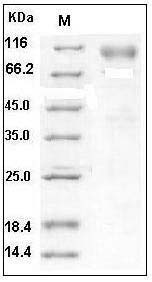 Human DR6 / TNFRSF21 Protein (Fc Tag) SDS-PAGE