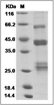 Influenza A H7N7 (A/equine/Kentucky/1a/1975) Hemagglutinin / HA Protein (His Tag) SDS-PAGE
