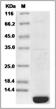 Human ACBD7 Protein (His Tag) SDS-PAGE