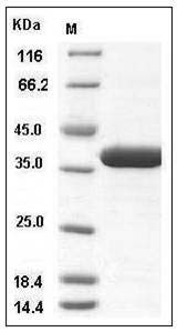 Human OTUB1 / OTB1 Protein (His Tag) SDS-PAGE