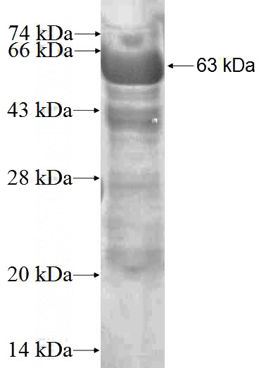 Recombinant Human EIF2B4 SDS-PAGE