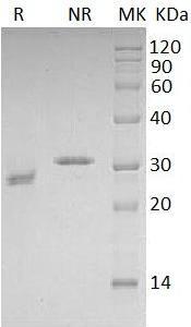 Human CDKN1B/KIP1 (His tag) recombinant protein