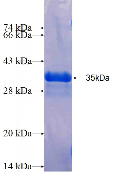 Recombinant Human PRB1 SDS-PAGE