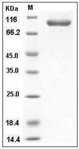 Human AGO1 / Argonaute 1 / EIF2C1 Protein (His Tag) SDS-PAGE