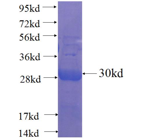 Recombinant human C19orf40 SDS-PAGE