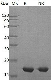 Human PMP2 (His tag) recombinant protein