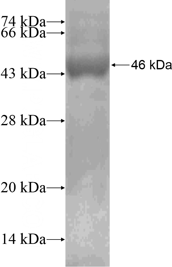 Recombinant Human SLC27A5 SDS-PAGE