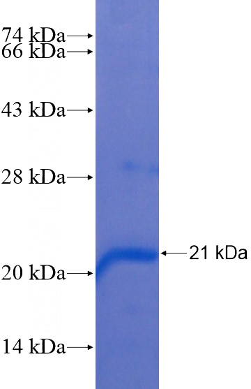 Recombinant Human OPN4 SDS-PAGE