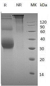 Mouse Ulbp1/mCG_117770 (His tag) recombinant protein