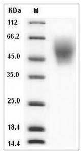 Human ICOS Ligand / B7-H2 / ICOSLG Protein (His Tag)