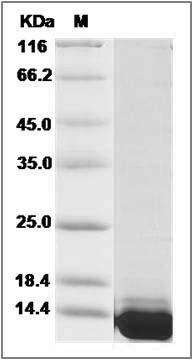 Mouse S100A11 / S100C Protein (His Tag) SDS-PAGE