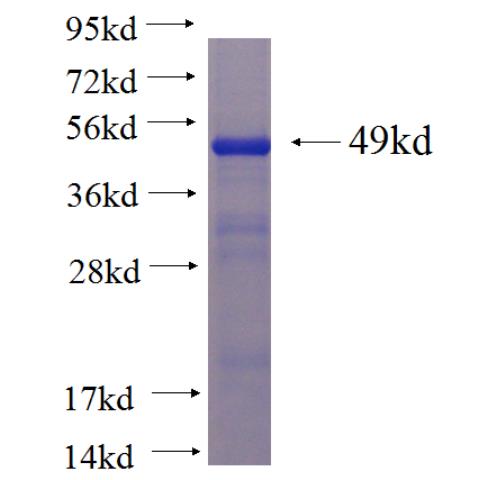 Recombinant human C16orf35 SDS-PAGE