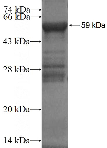 Recombinant Human SNX14 SDS-PAGE