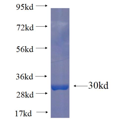 Recombinant human MED18 SDS-PAGE