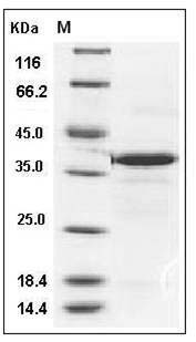 Mouse Carbonic Anhydrase VIII / Car8 Protein (His Tag) SDS-PAGE