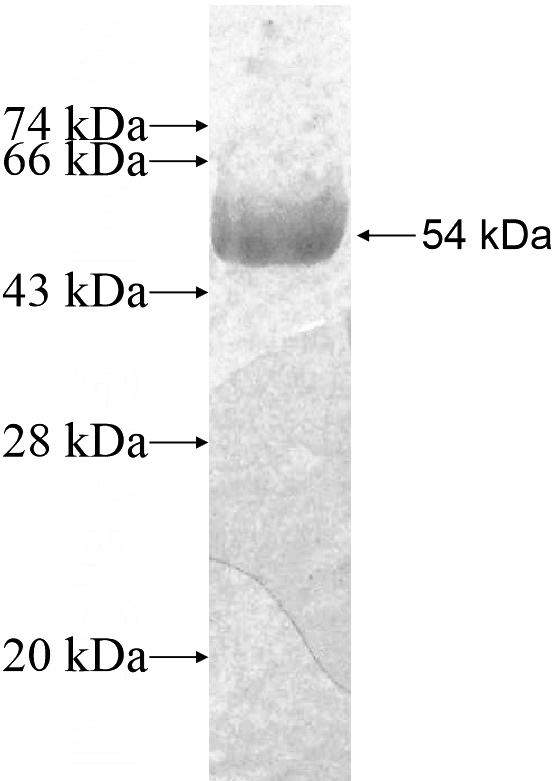 Recombinant Human HIP1R SDS-PAGE