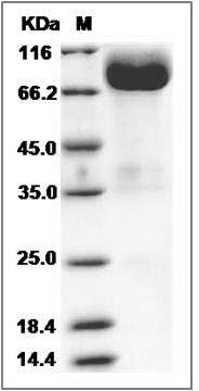Cynomolgus SIRPG / SIRP gamma / CD172g Protein (Fc Tag) SDS-PAGE