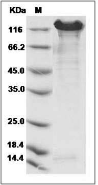 Human E-Cadherin / CDH1 / E-cad / CD324 Protein (Fc Tag) SDS-PAGE
