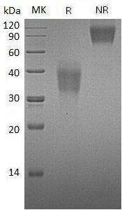 Mouse Pdcd1/Pd1 (His tag) recombinant protein