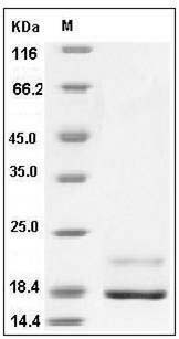 Human REG4 / RELP / GISP Protein (His Tag) SDS-PAGE