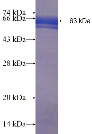 Recombinant Human DHX57 SDS-PAGE