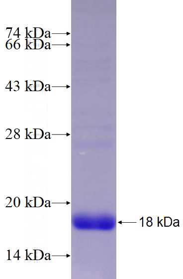 Recombinant Human GPR61 SDS-PAGE