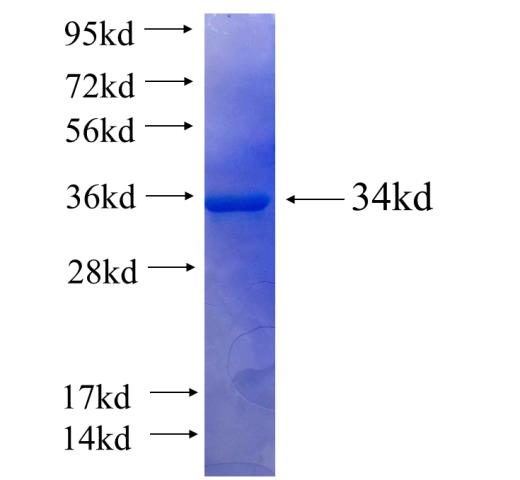 Recombinant human HSBP1(Full length) SDS-PAGE