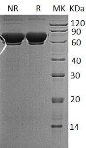 Human MAN1B1/UNQ747/PRO1477 (His tag) recombinant protein