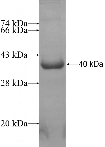 Recombinant Human ABHD6 SDS-PAGE