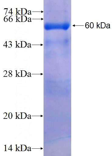 Recombinant Human FBXW2 SDS-PAGE