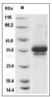 Rat Ephrin-B1 / EFNB1 Protein (His Tag) SDS-PAGE