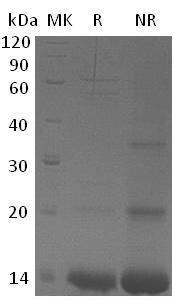 Human ZNF75A (His tag) recombinant protein